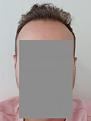 Click image for larger version

Name:	front hair copy.jpg
Views:	461
Size:	4.9 KB
ID:	491813