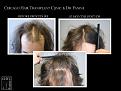 Click image for larger version

Name:	Slide3.jpg
Views:	187
Size:	66.0 KB
ID:	491847