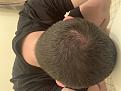 Click image for larger version

Name:	bald1.jpg
Views:	354
Size:	92.8 KB
ID:	491889