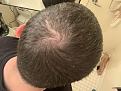 Click image for larger version

Name:	bald4.jpg
Views:	930
Size:	89.0 KB
ID:	491891