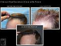 Click image for larger version

Name:	Slide3.jpg
Views:	194
Size:	72.1 KB
ID:	492047