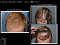 Click image for larger version

Name:	Slide7.jpg
Views:	199
Size:	68.7 KB
ID:	492051