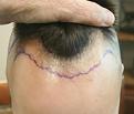 Click image for larger version

Name:	0-3.jpg
Views:	231
Size:	10.9 KB
ID:	492091