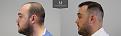Click image for larger version

Name:	6Before_After_Left.jpg
Views:	400
Size:	77.5 KB
ID:	492218