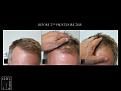 Click image for larger version

Name:	Slide3.JPG
Views:	198
Size:	72.3 KB
ID:	492233