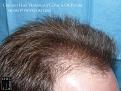Click image for larger version

Name:	Slide8.jpg
Views:	196
Size:	96.5 KB
ID:	492238