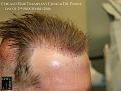 Click image for larger version

Name:	Slide18.jpg
Views:	194
Size:	79.5 KB
ID:	492248