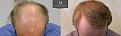 Click image for larger version

Name:	ID566_Before_After_Front_top.jpg
Views:	261
Size:	94.5 KB
ID:	492300