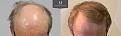 Click image for larger version

Name:	ID566_Before_After_Front_tilt.jpg
Views:	255
Size:	95.0 KB
ID:	492304