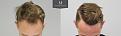 Click image for larger version

Name:	ID719-Before-after_front_tilt.jpg
Views:	457
Size:	94.2 KB
ID:	492414