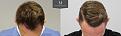 Click image for larger version

Name:	ID719-Before-after_front-top.jpg
Views:	436
Size:	94.1 KB
ID:	492415