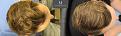 Click image for larger version

Name:	ID719-Before-after_above.jpg
Views:	426
Size:	99.1 KB
ID:	492417