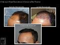 Click image for larger version

Name:	Slide3.jpg
Views:	166
Size:	62.4 KB
ID:	492589