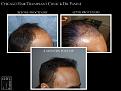 Click image for larger version

Name:	Slide4.jpg
Views:	169
Size:	66.0 KB
ID:	492590