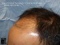 Click image for larger version

Name:	Slide9.jpg
Views:	165
Size:	79.5 KB
ID:	492595