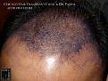 Click image for larger version

Name:	Slide11.jpg
Views:	178
Size:	94.8 KB
ID:	492597