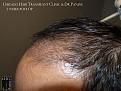 Click image for larger version

Name:	Slide16.jpg
Views:	167
Size:	89.0 KB
ID:	492602