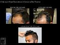 Click image for larger version

Name:	Slide3.jpg
Views:	200
Size:	58.9 KB
ID:	492817