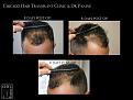Click image for larger version

Name:	Slide5.jpg
Views:	206
Size:	61.3 KB
ID:	492819