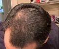 Click image for larger version

Name:	IMG_0589.jpg
Views:	244
Size:	93.7 KB
ID:	492849