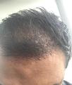 Click image for larger version

Name:	hairs 1.jpg
Views:	286
Size:	78.8 KB
ID:	493822