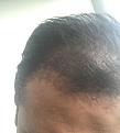 Click image for larger version

Name:	hairs 2.jpg
Views:	261
Size:	74.1 KB
ID:	493823
