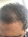 Click image for larger version

Name:	hairs 3.jpg
Views:	259
Size:	82.9 KB
ID:	493824