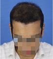 Click image for larger version

Name:	Slide8.JPG
Views:	274
Size:	94.4 KB
ID:	493922