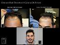 Click image for larger version

Name:	Slide2.jpg
Views:	341
Size:	62.5 KB
ID:	493936