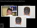 Click image for larger version

Name:	Slide5.JPG
Views:	316
Size:	88.0 KB
ID:	493939