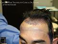 Click image for larger version

Name:	Slide10.jpg
Views:	317
Size:	70.6 KB
ID:	493944