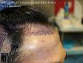 Click image for larger version

Name:	Slide12.jpg
Views:	325
Size:	86.7 KB
ID:	493946
