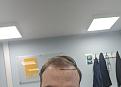 Click image for larger version

Name:	hair line.jpg
Views:	352
Size:	70.2 KB
ID:	494061