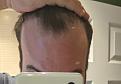 Click image for larger version

Name:	front of hair.jpg
Views:	346
Size:	81.7 KB
ID:	494062