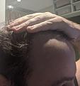 Click image for larger version

Name:	side of head.jpg
Views:	312
Size:	85.1 KB
ID:	494064