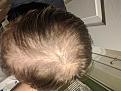 Click image for larger version

Name:	hair parted.jpg
Views:	339
Size:	88.0 KB
ID:	494065