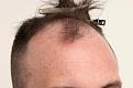 Click image for larger version

Name:	drtrue (10).jpg
Views:	243
Size:	93.4 KB
ID:	494261