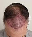 Click image for larger version

Name:	drtrue (15).jpg
Views:	249
Size:	95.1 KB
ID:	494266