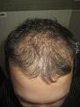 Click image for larger version

Name:	IMG_0338.jpg
Views:	293
Size:	93.8 KB
ID:	494492