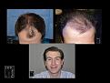Click image for larger version

Name:	Slide2.JPG
Views:	208
Size:	84.9 KB
ID:	494578