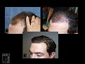 Click image for larger version

Name:	Slide4.JPG
Views:	202
Size:	87.2 KB
ID:	494580