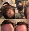 Click image for larger version

Name:	Hair_Nima.jpg
Views:	657
Size:	87.9 KB
ID:	494789