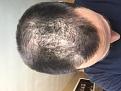 Click image for larger version

Name:	bald2.jpg
Views:	365
Size:	17.0 KB
ID:	494809