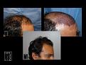 Click image for larger version

Name:	Slide3.jpg
Views:	197
Size:	61.8 KB
ID:	494823