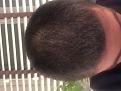 Click image for larger version

Name:	Hair 1.jpg
Views:	176
Size:	91.0 KB
ID:	494861