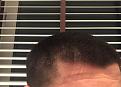 Click image for larger version

Name:	Hair 4.jpg
Views:	163
Size:	92.3 KB
ID:	494864