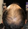 Click image for larger version

Name:	unnamed-7.jpg
Views:	210
Size:	91.2 KB
ID:	494993