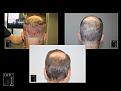 Click image for larger version

Name:	Slide6.JPG
Views:	164
Size:	85.2 KB
ID:	495019