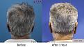 Click image for larger version

Name:	fif.jpg
Views:	234
Size:	92.9 KB
ID:	495072