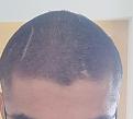 Click image for larger version

Name:	IMG_20200517_150443__01__01.jpg
Views:	328
Size:	72.9 KB
ID:	495212